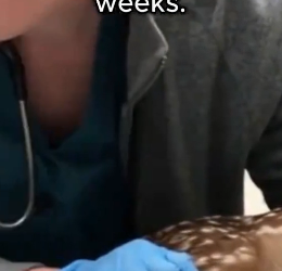 F1906003 I Rescued a Baby Deer… One Year Later, It Came Back (Part 2)