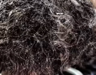 X1306008 Very Dirty Homeless Man Incredible Haircut Transformation Rescued Form Jungle (Part 2)