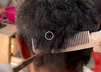 X1606004 Extreme Dirty Hair Transformation 😱 _ Mud-Covered Hair Rescue & Haircut ✂️ (Part 2)