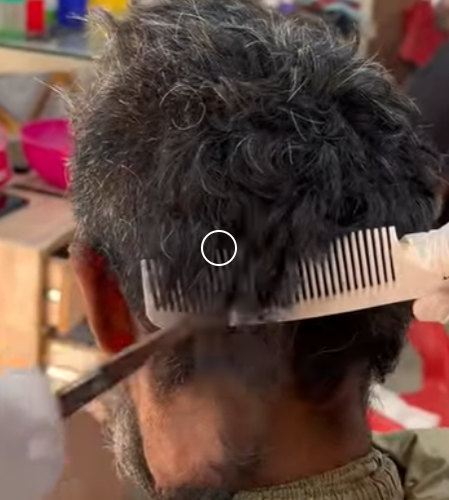 X1606004 Extreme Dirty Hair Transformation 😱 _ Mud-Covered Hair Rescue & Haircut ✂️ (Part 2)